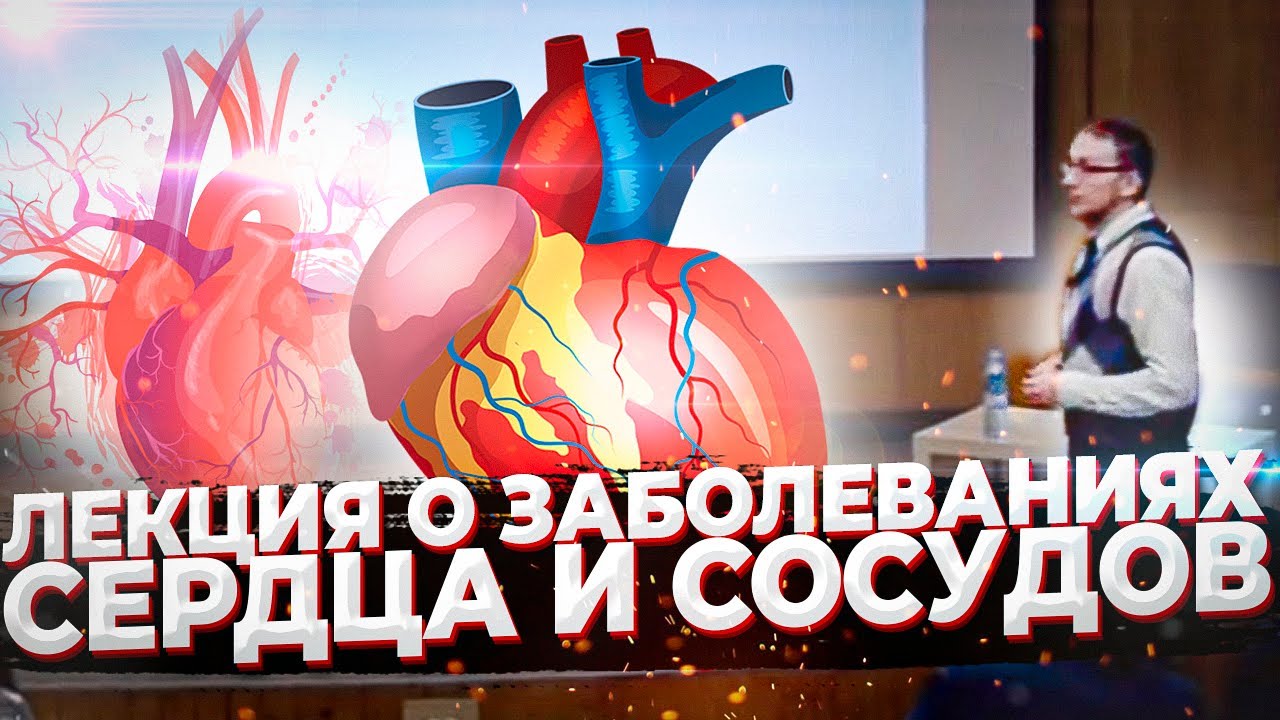 Лекция «Атеросклероз – чума 20 века»