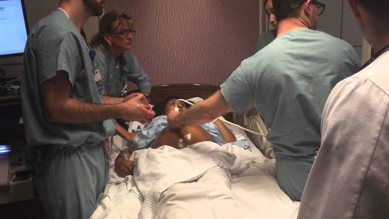 Successful External Cephalic Version (ECV)