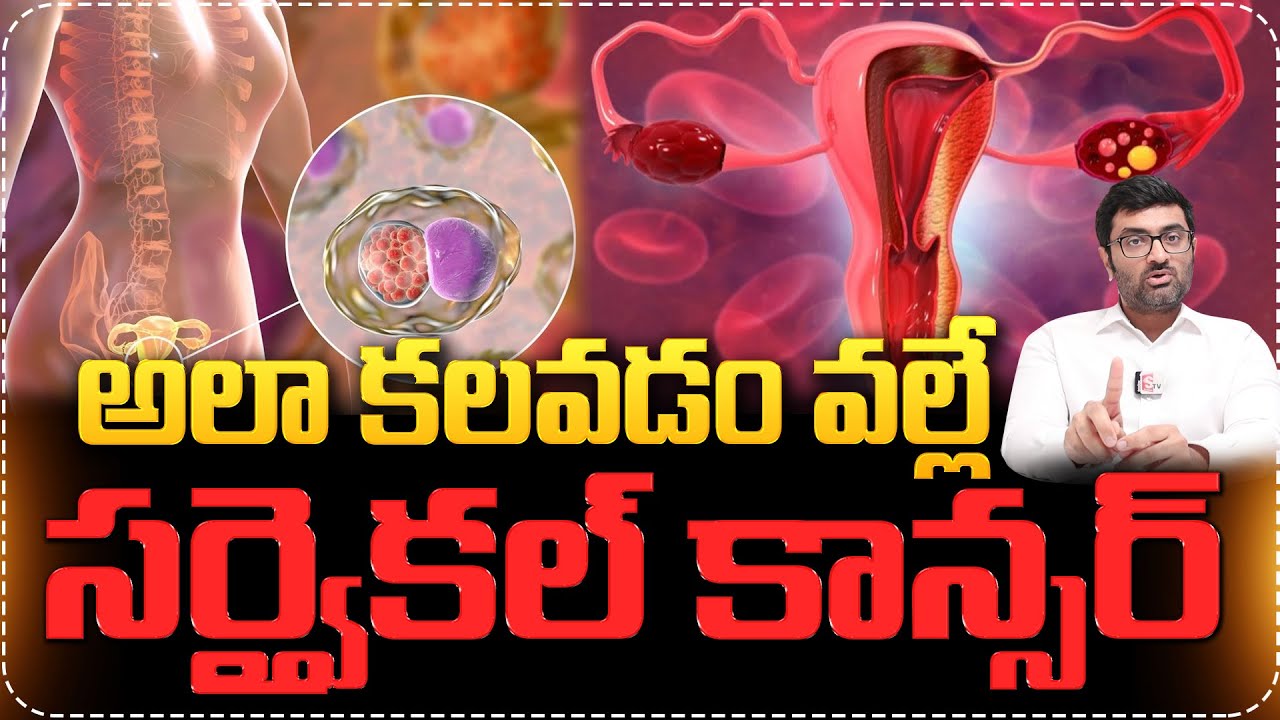 అలా కలవడం వల్లే సర్వైకల్ కాన్సర్ వస్తుంది..|Cervical Cancer Symptoms And Treatment | Cervical Cancer