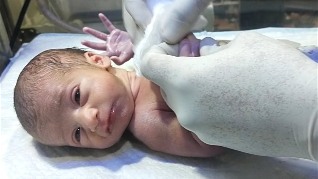 Newborn Baby Suction Procedure in NICU | How to Safely Remove Mucus#newbornbaby#cutebaby