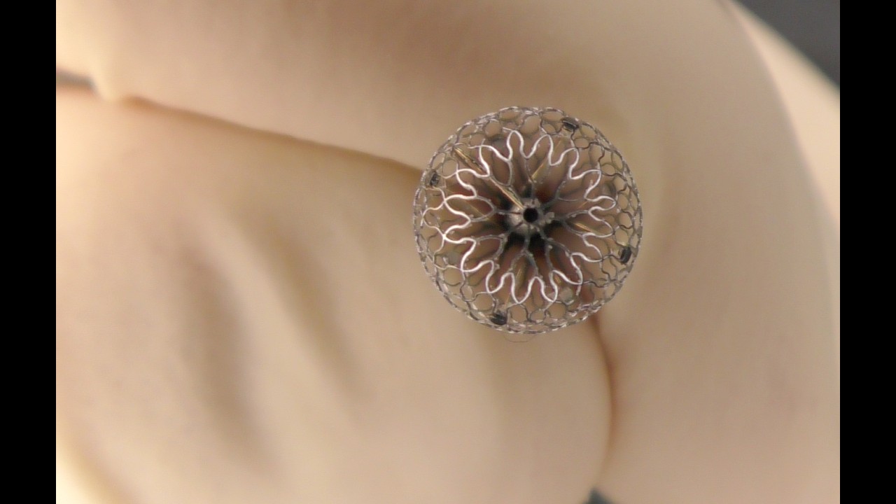 Anatomical correlations with Medtronic #Affera and #Sphere9 ablation lines