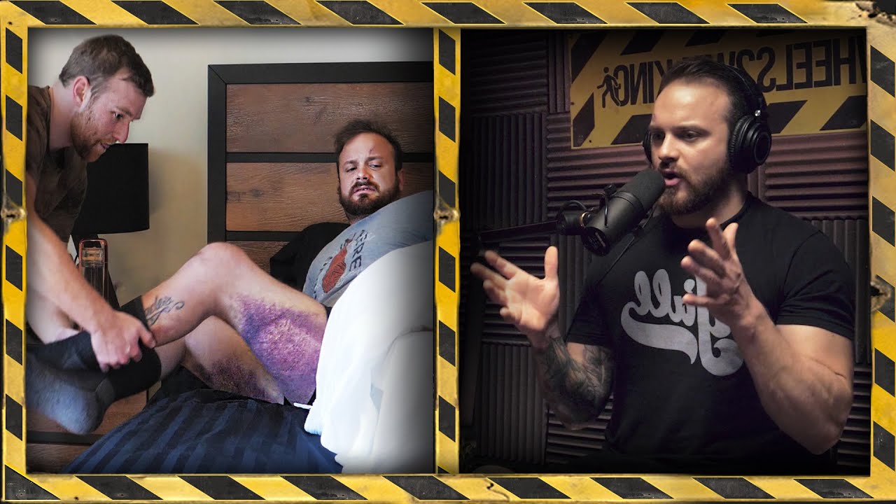 Richard&rsquo;s Recovery Update (18 days since getting hit by a car)
