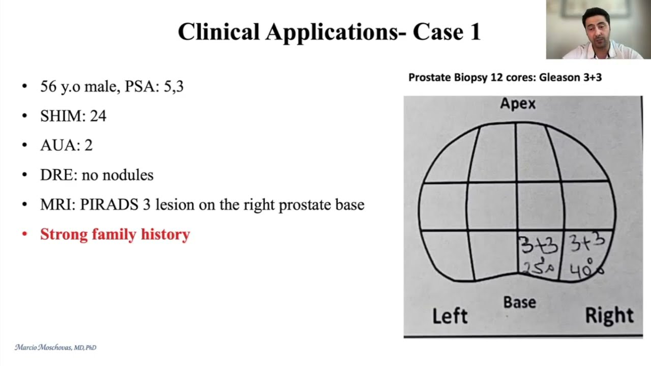 Uncovering Hidden Aggression GPS mdx Studies on AP
