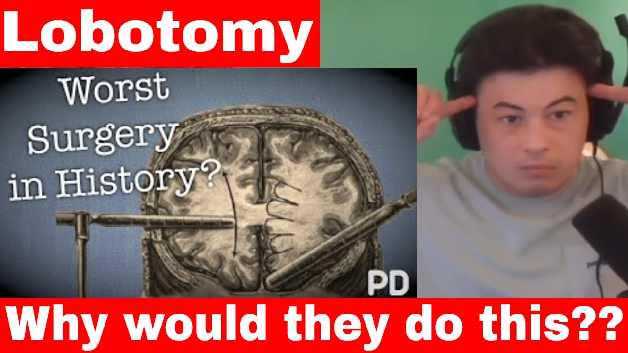 American Reacts The Dark side of Science: The Lobotomy, the worst surgery in history?