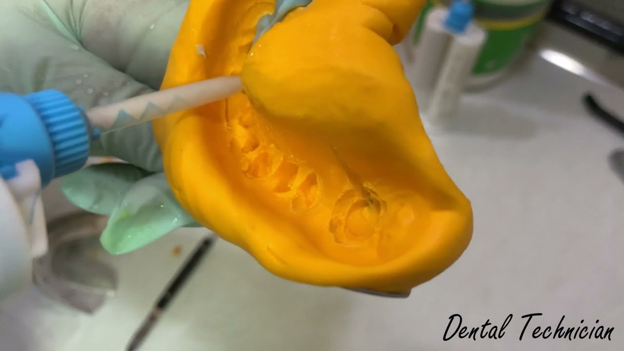 Dental impression for zirconia bridge