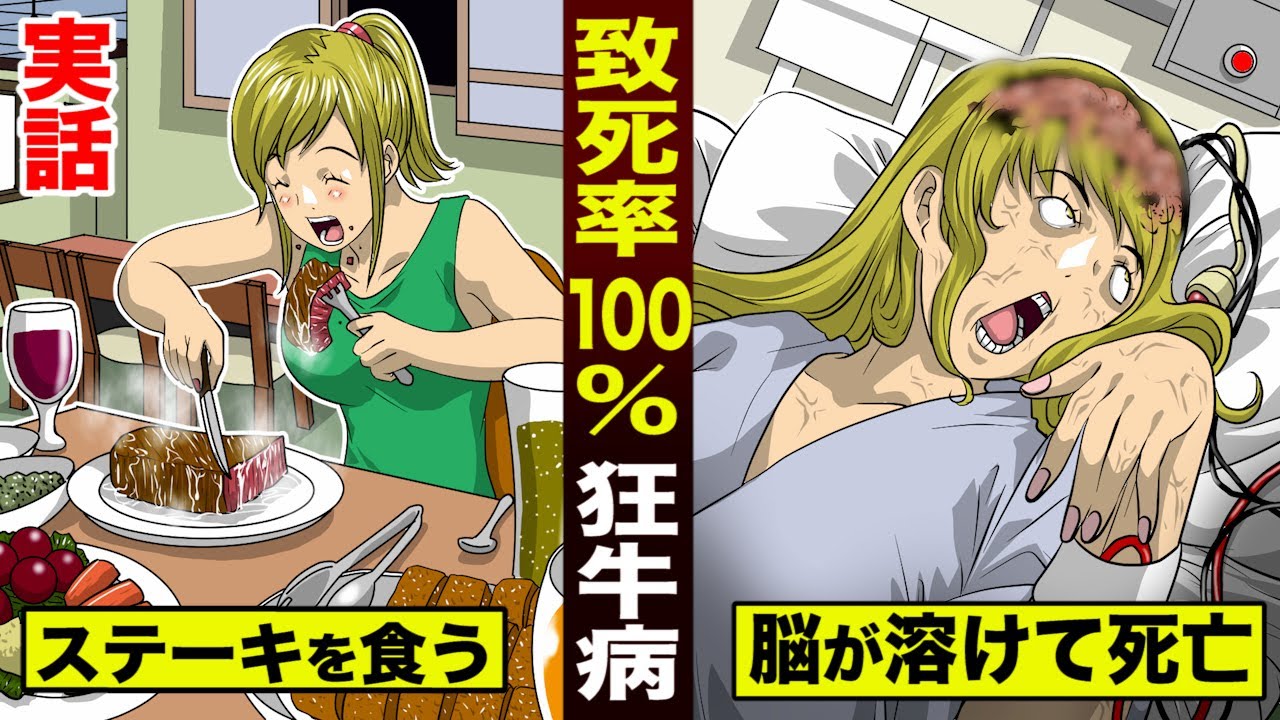 【実話】致死率100%…狂牛病。脳が溶けて確実に死ぬ。