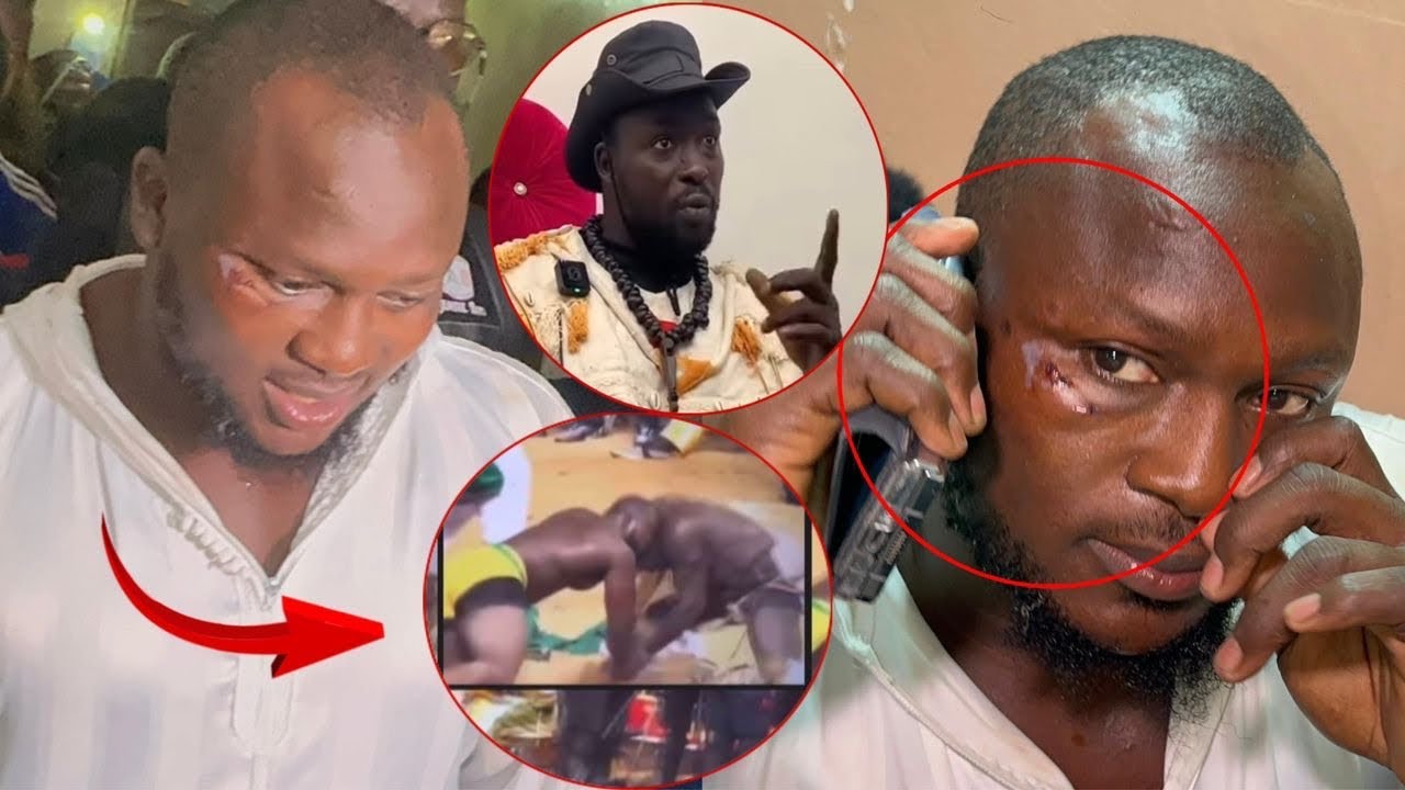 Touché par Siteu et Blessé après le combat , Modou Lô apparaît devant ses Fans Chez lui «….