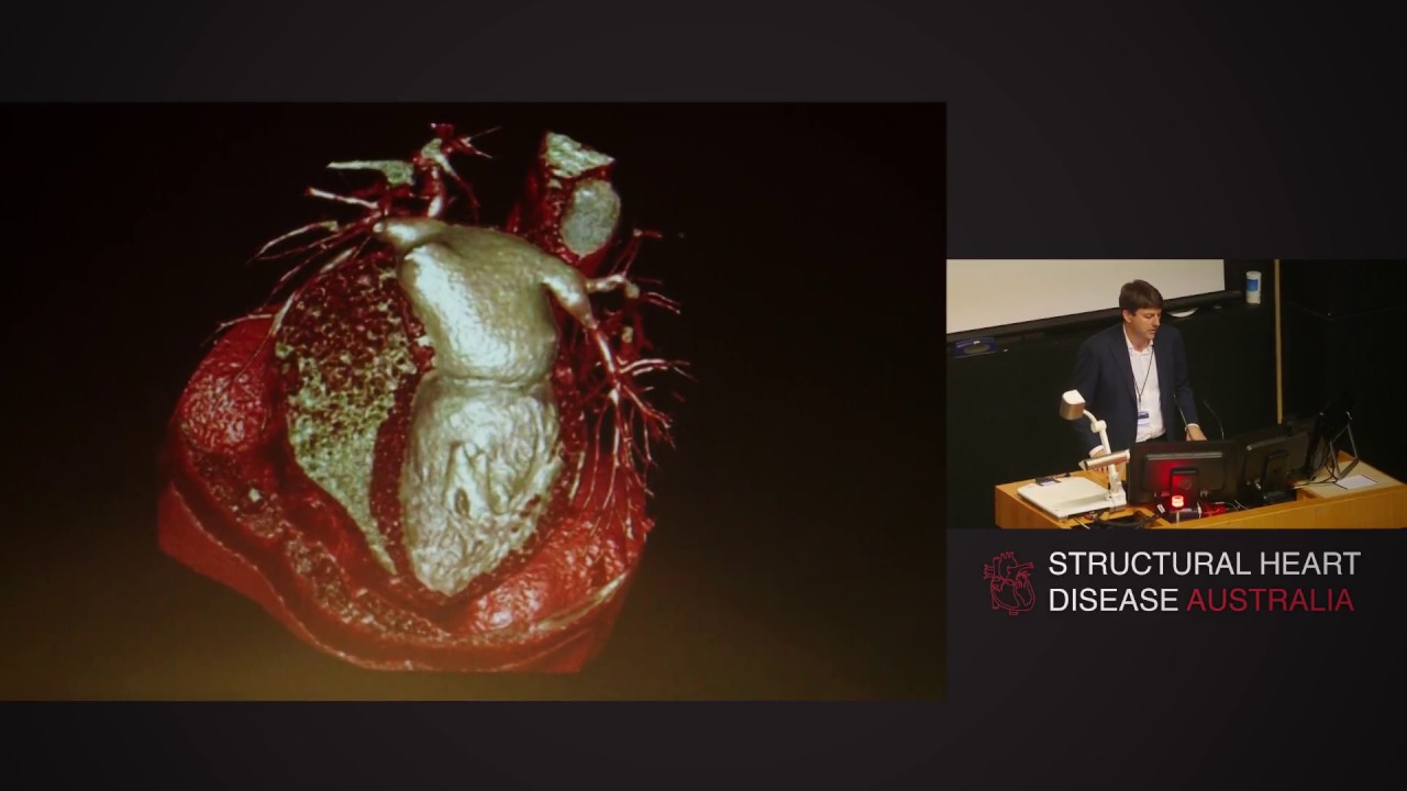 Cardiovascular 3D printing and simulation - Dr James Otton