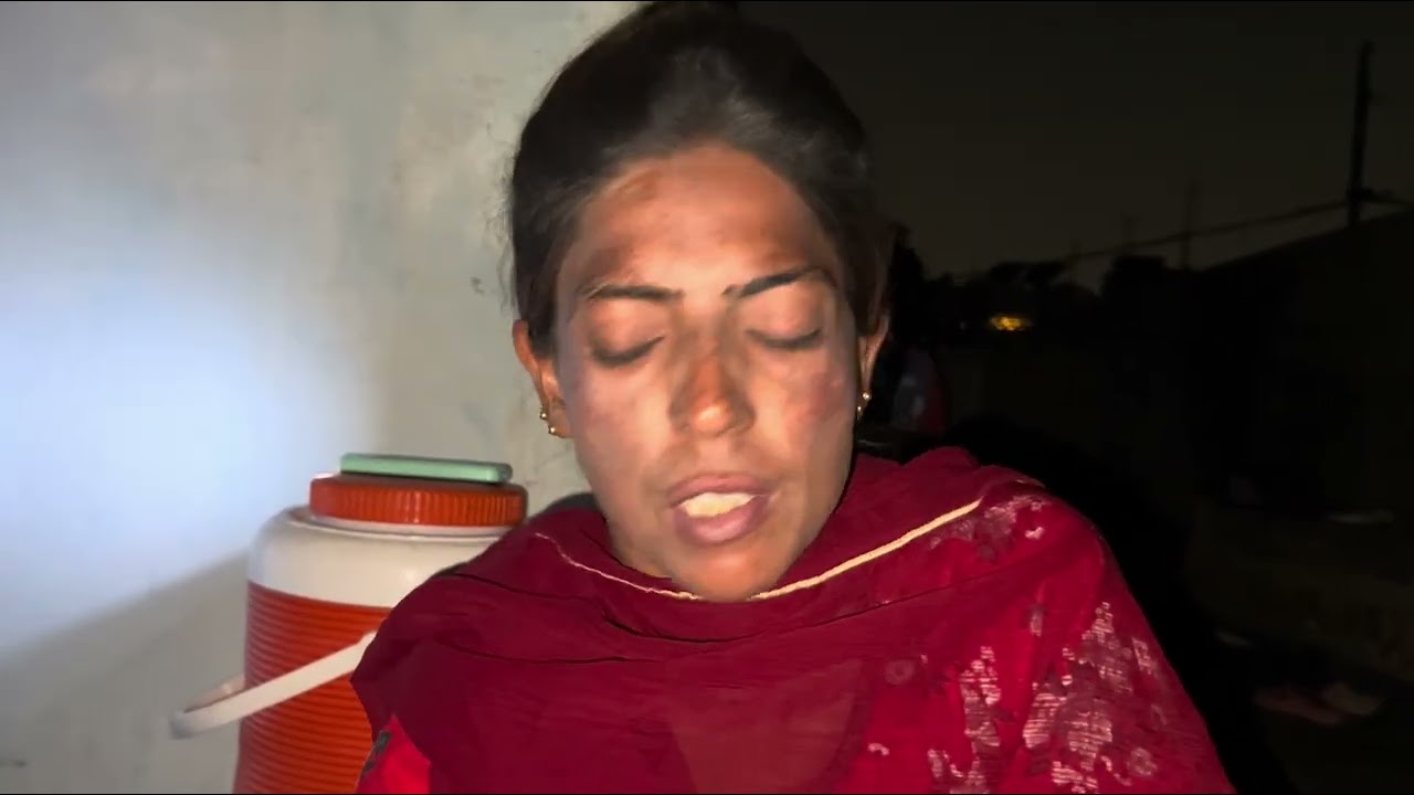 Aami Ke Liye ap sab Dua Karen / gopal sonia