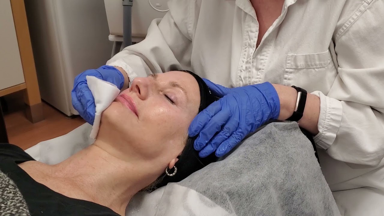 Microneedling Training - Edermastamp