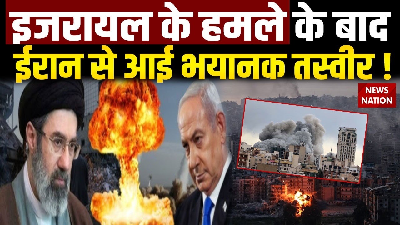 Israel-US vs Iran : इजरायल के हमले के बाद ईरान से आई भयानक Photos |Trump | America| Khamenei |attack