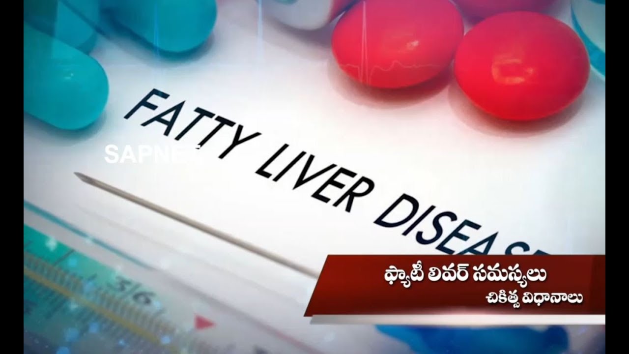 Health Guide | Treatment For Fatty Liver Diseases | EP 72 | AP Prime Tv | SAPNET