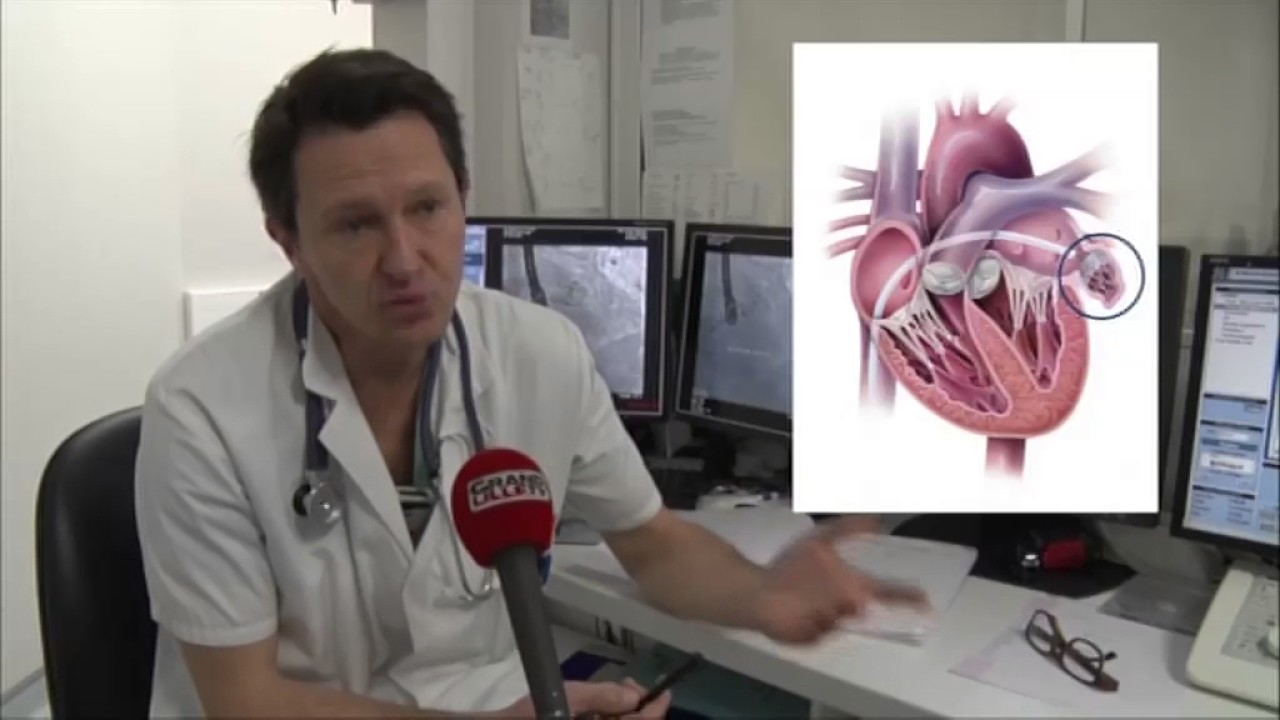 Traitement pour l'arythmie cardiaque