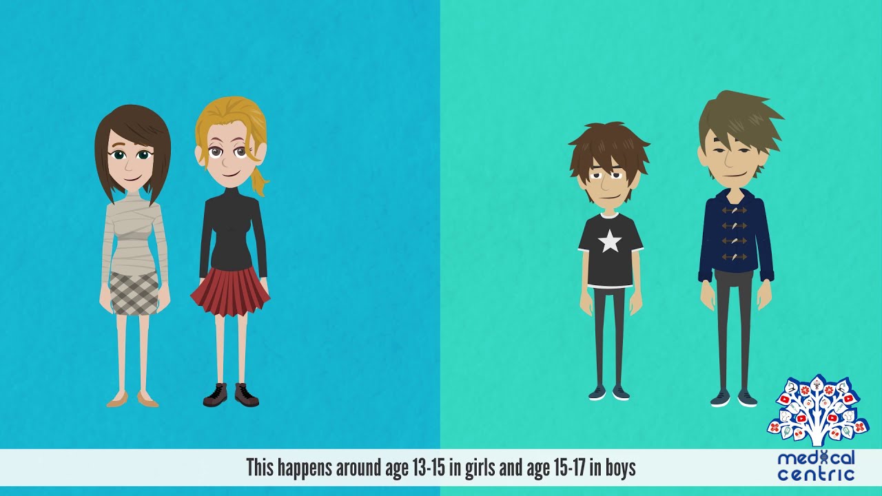 Gigantism, Causes, Signs and Symptoms, Diagnosis and Treatment