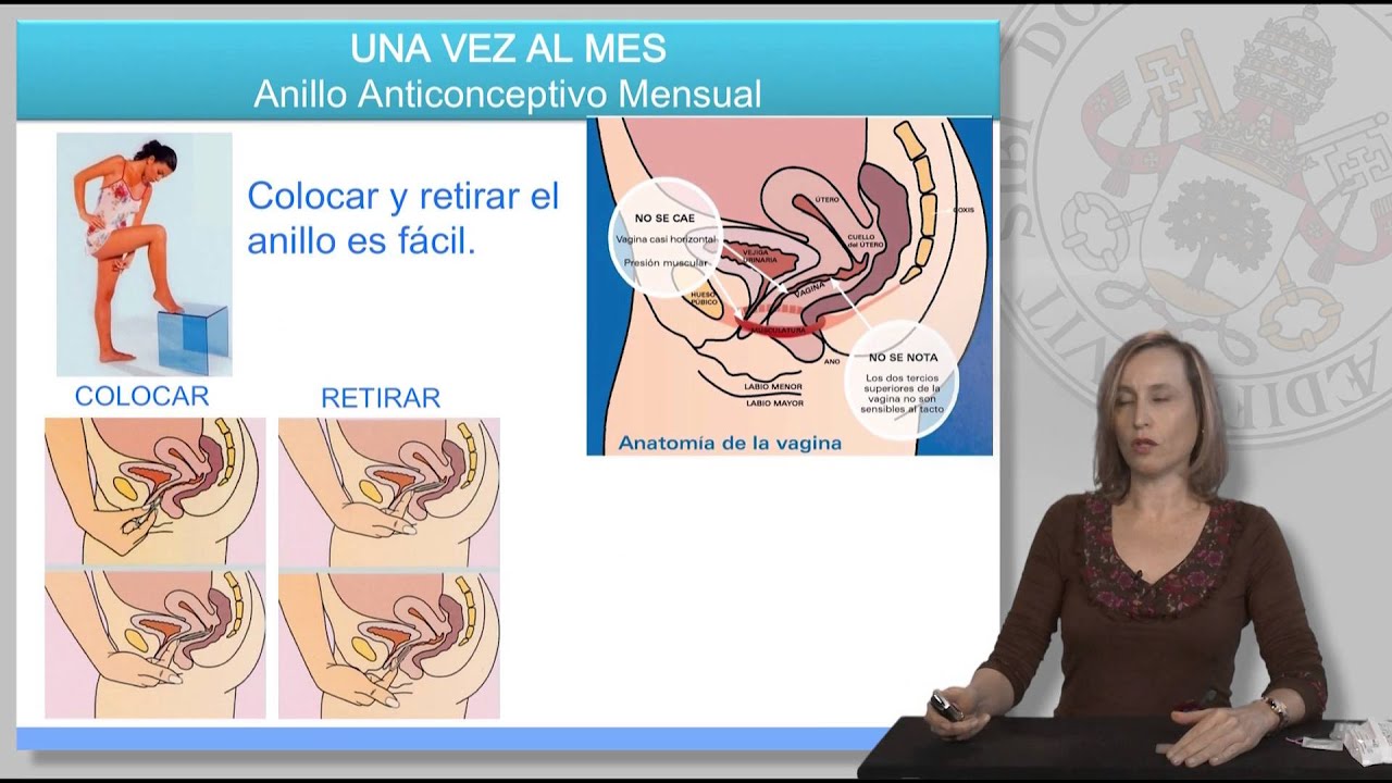 MÉTODOS ANTICONCEPTIVOS HORMONALES