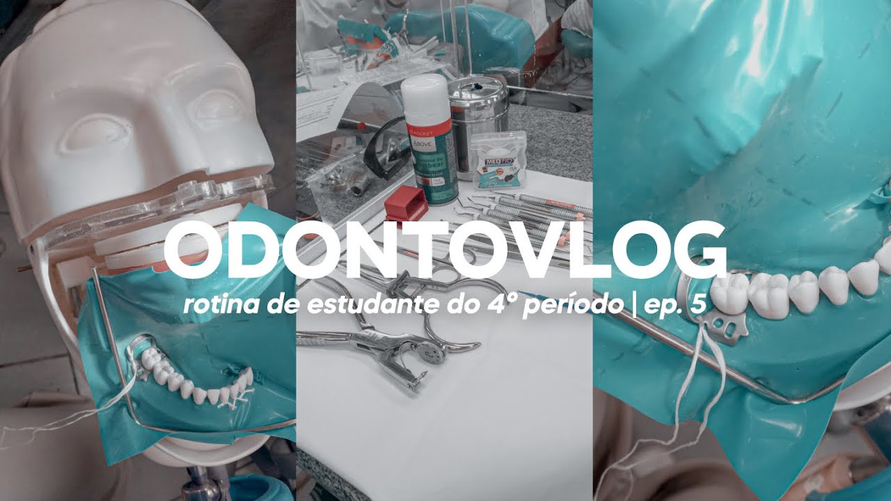 ODONTOVLOG #5: minha primeira restaura&ccedil;&atilde;o dent&aacute;ria | Odonto Energy