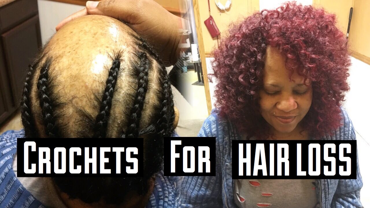 CROCHETS FOR HAIR LOSS CLIENTS
