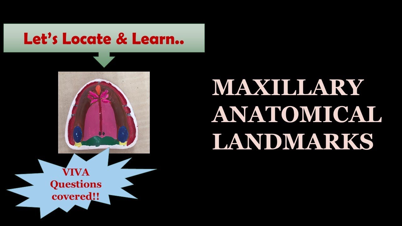 MAXILLARY ANATOMICAL LANDMARKS / MARKING ON MODEL / DENTURE BEARING AREA