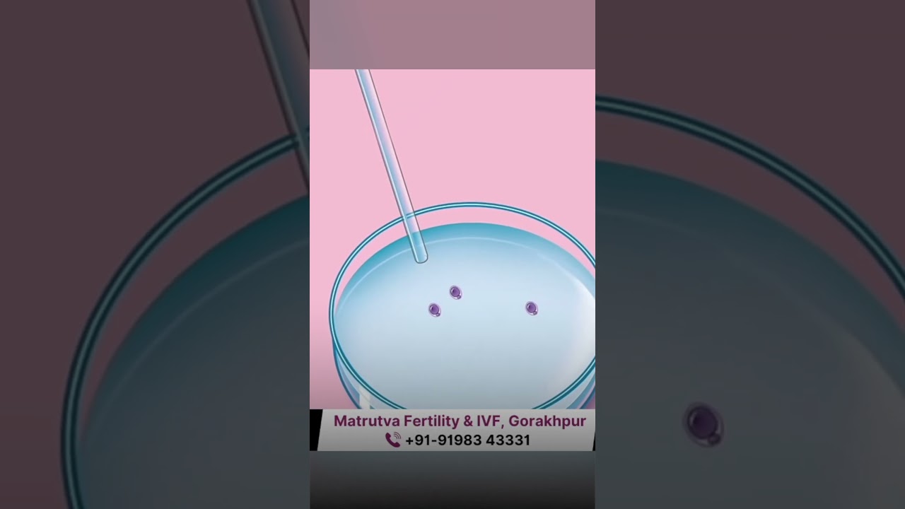 IVF का क्या मतलब होता है? | What is the meaning of IVF #womenshealth #pregnancy