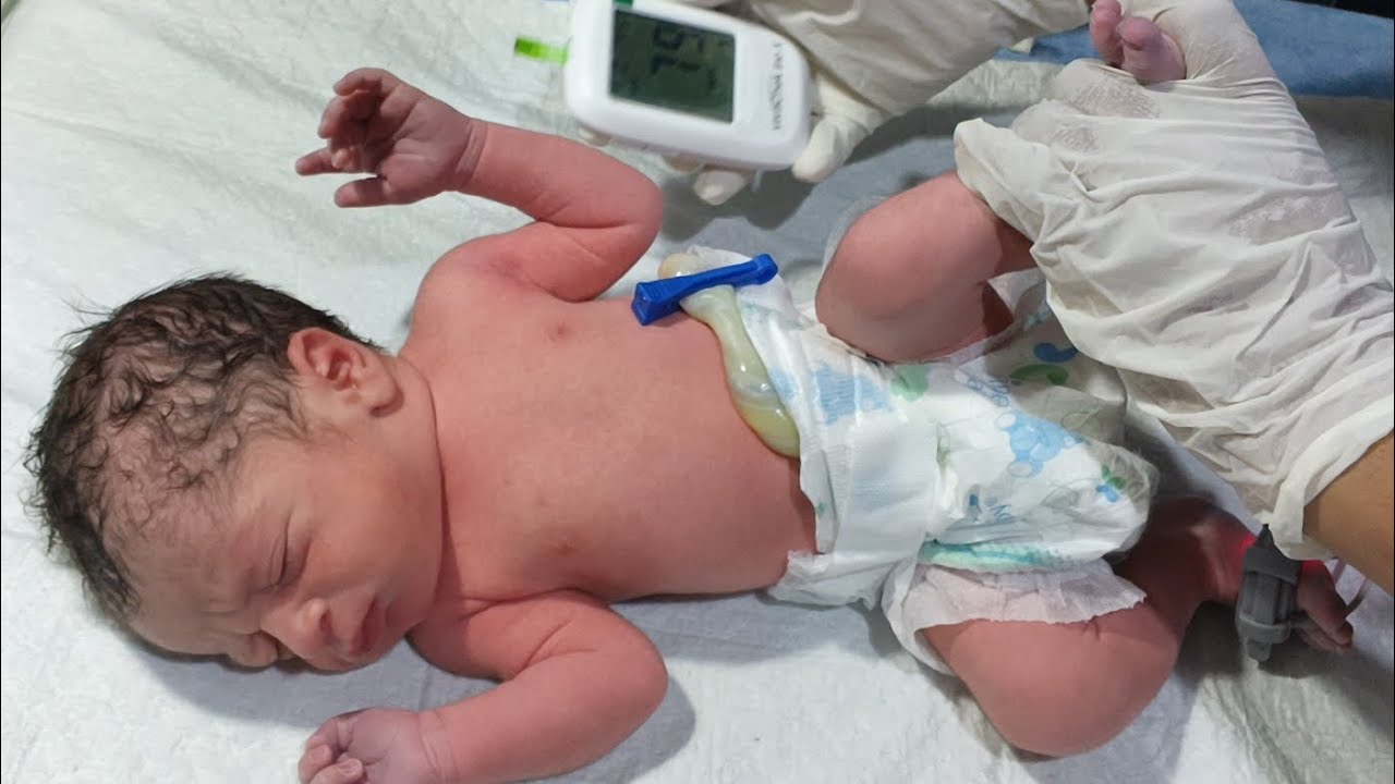 Newborn Baby Peripheral Cyanosis | RBS Monitoring | Initial Assessment After C-Section | NICU Care