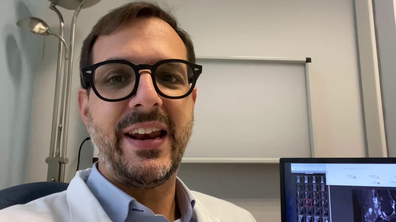 Interventi al ginocchio: ricostruzione legamenti crociati e menisco