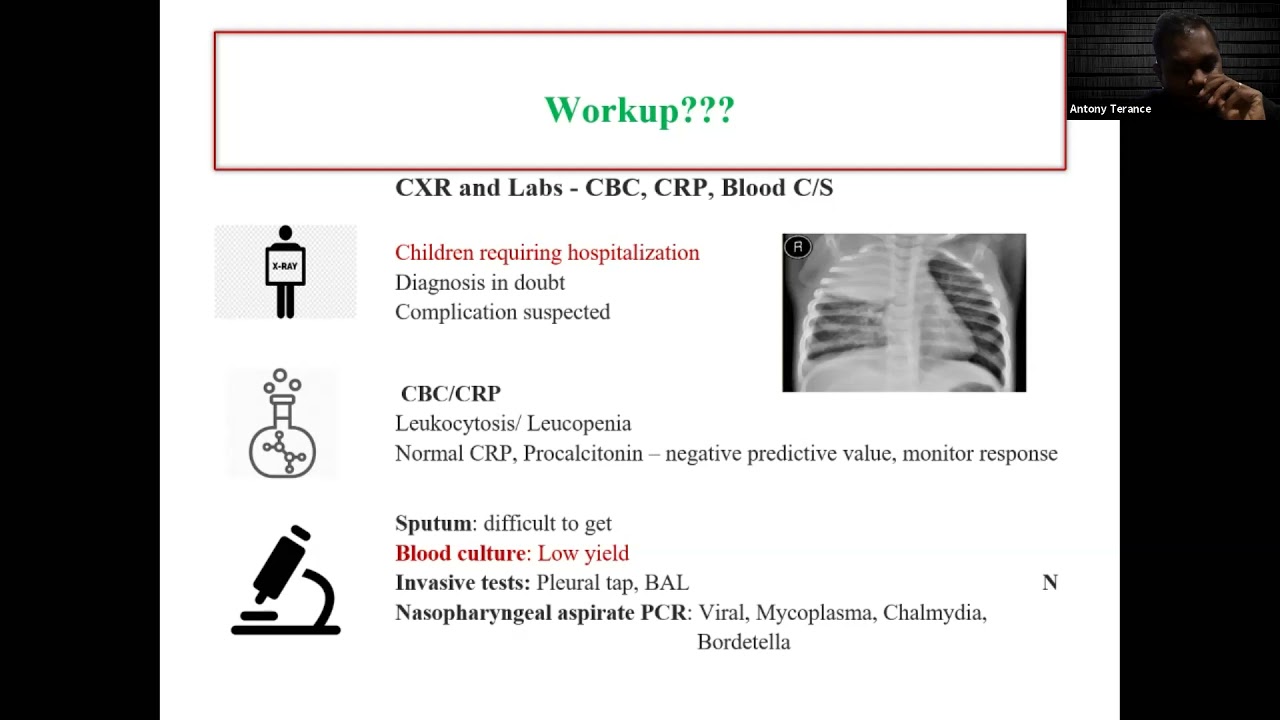 Childhood Pneumonia  - Dr. Antony terrace