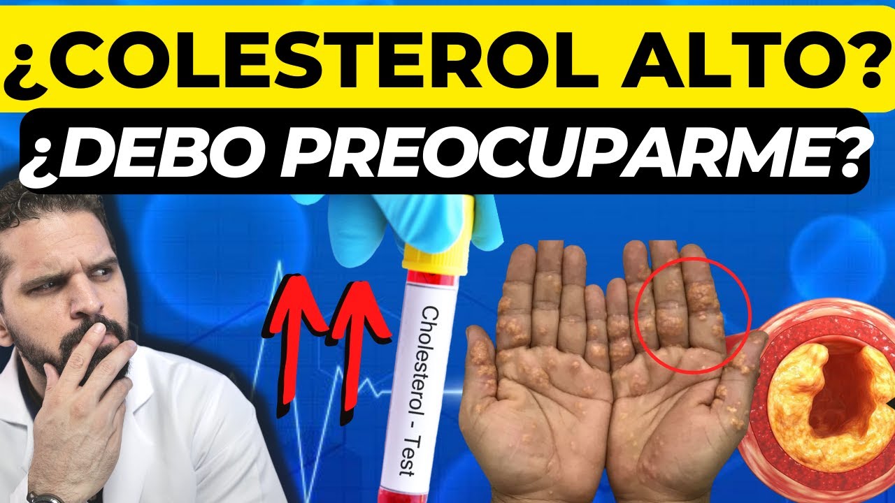 💥COLESTEROL ALTO( SINTOMAS Y CAUSAS):¿QUÉ HACER? ¿DIETA O 💊?
