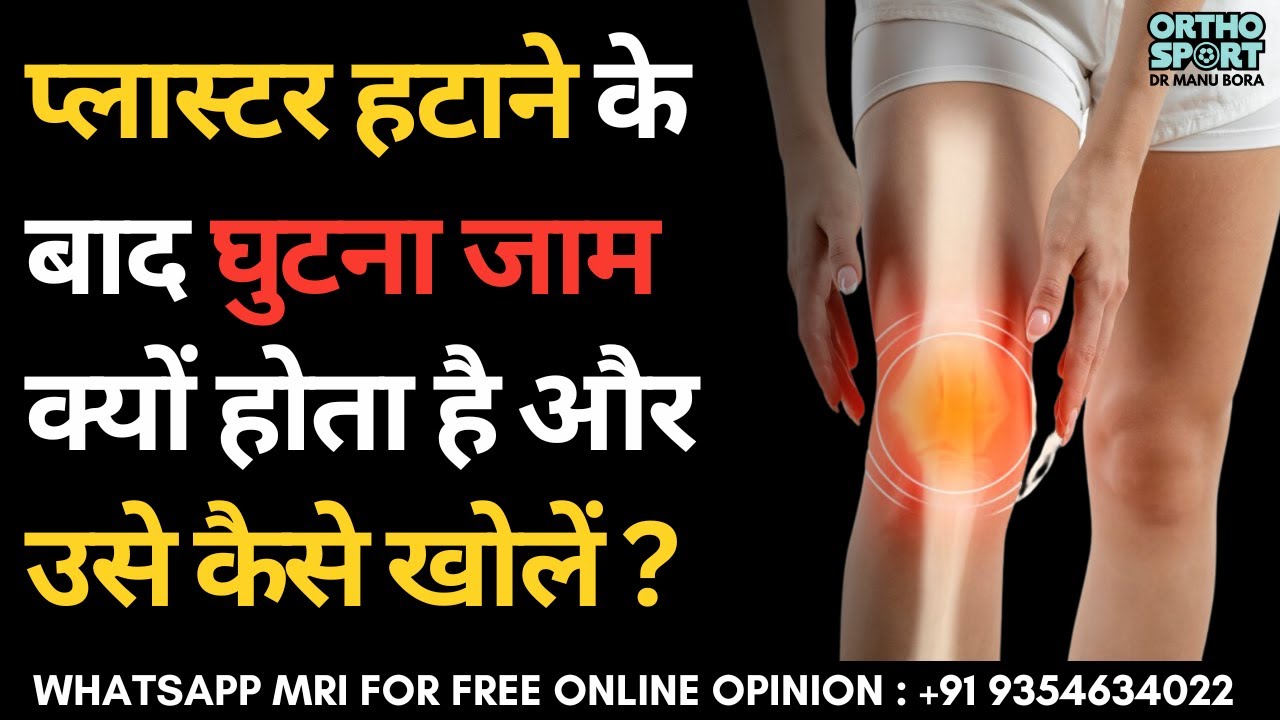 प्लास्टर हटाने के बाद घुटना जाम क्यों होता है और उसे कैसे खोलें ? Locked Knee after Plaster/ Cast