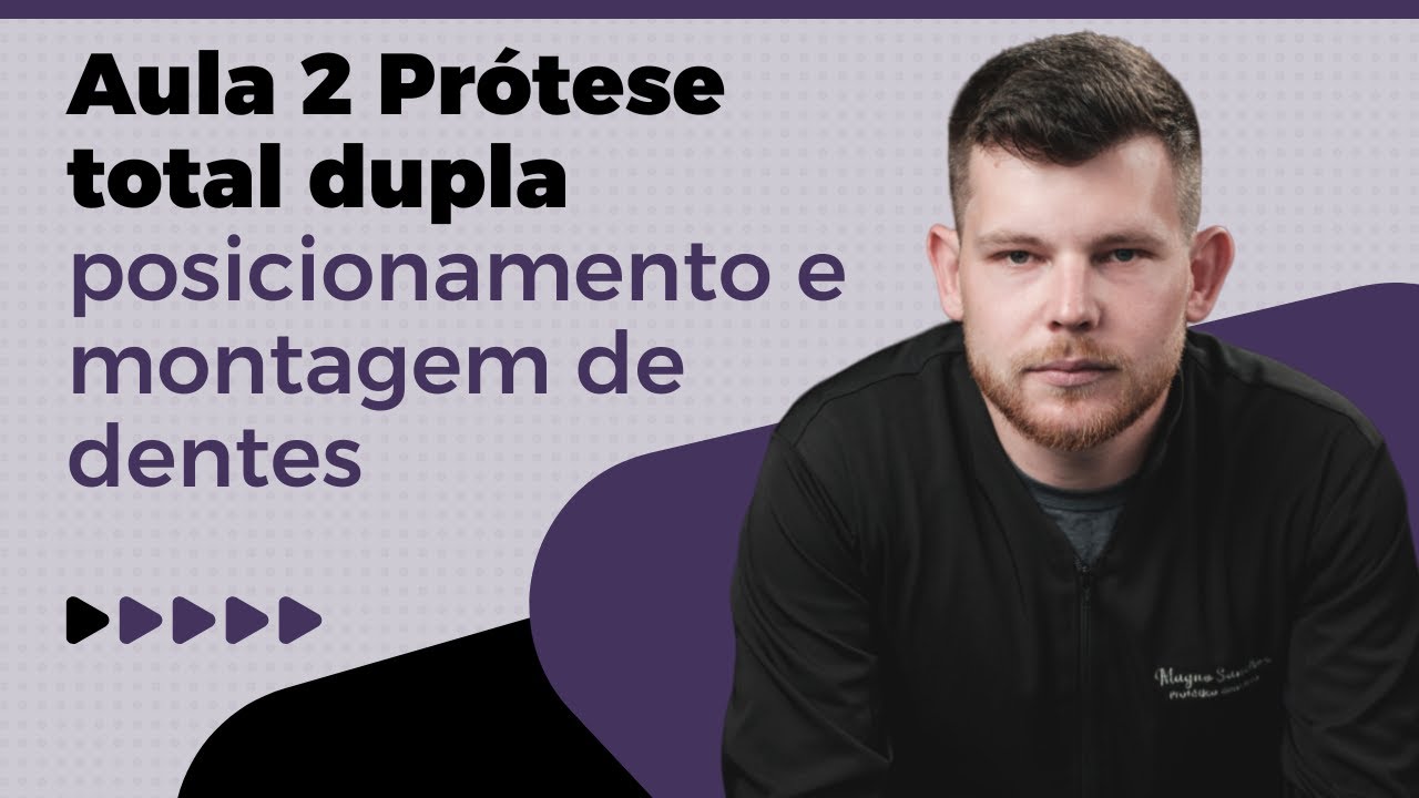 Aula 2 Prótese Total Dupla - Posicionamento e Montagem de Dentes