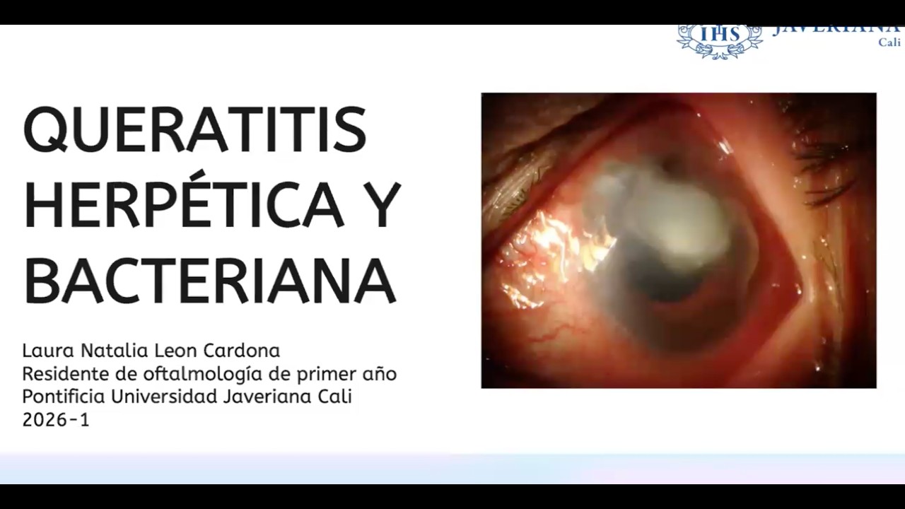 QUERATITIS  BACTERIANA Y HERPETICA