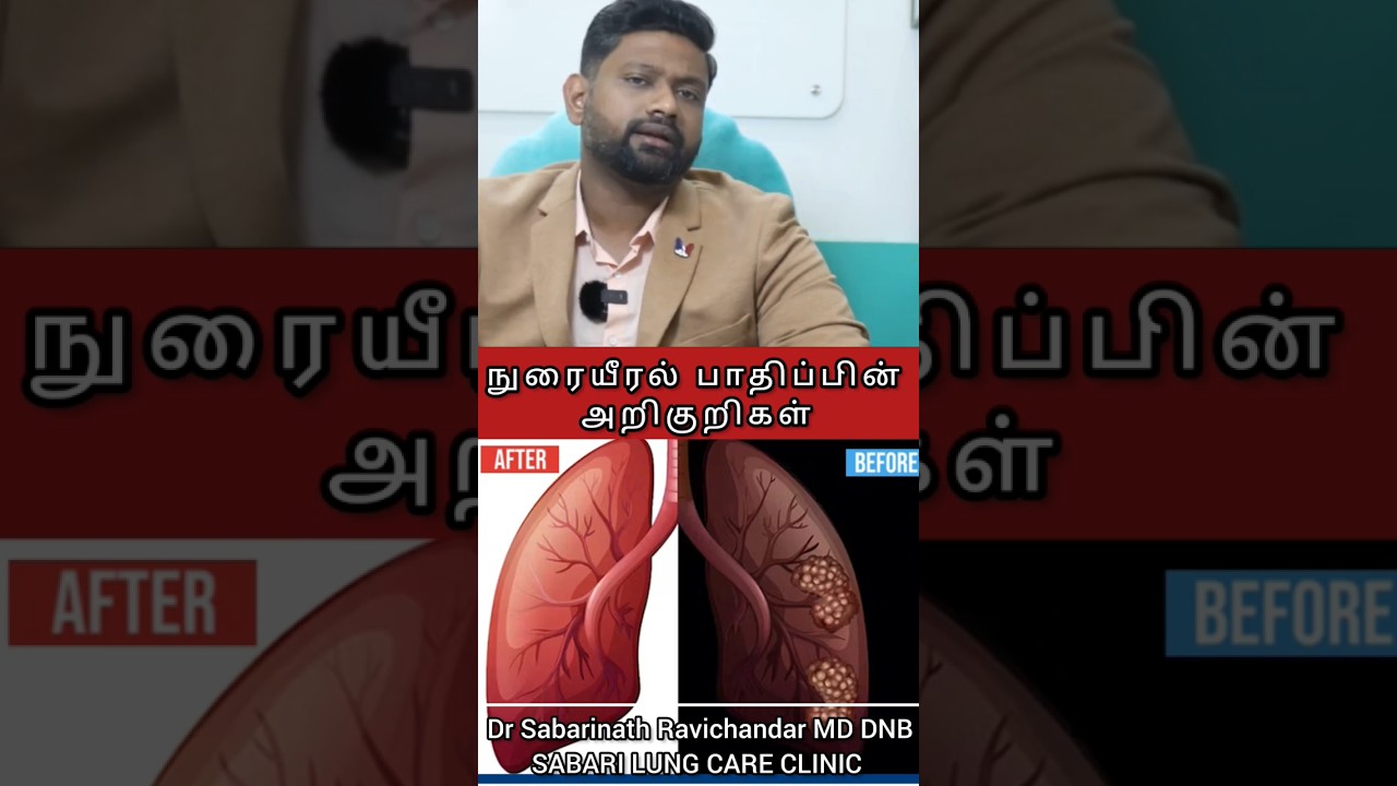 LUNG CLEANSING PART 8| Lung Problem Symptoms| Dr Sabarinath Ravichandar MD DNB explains|