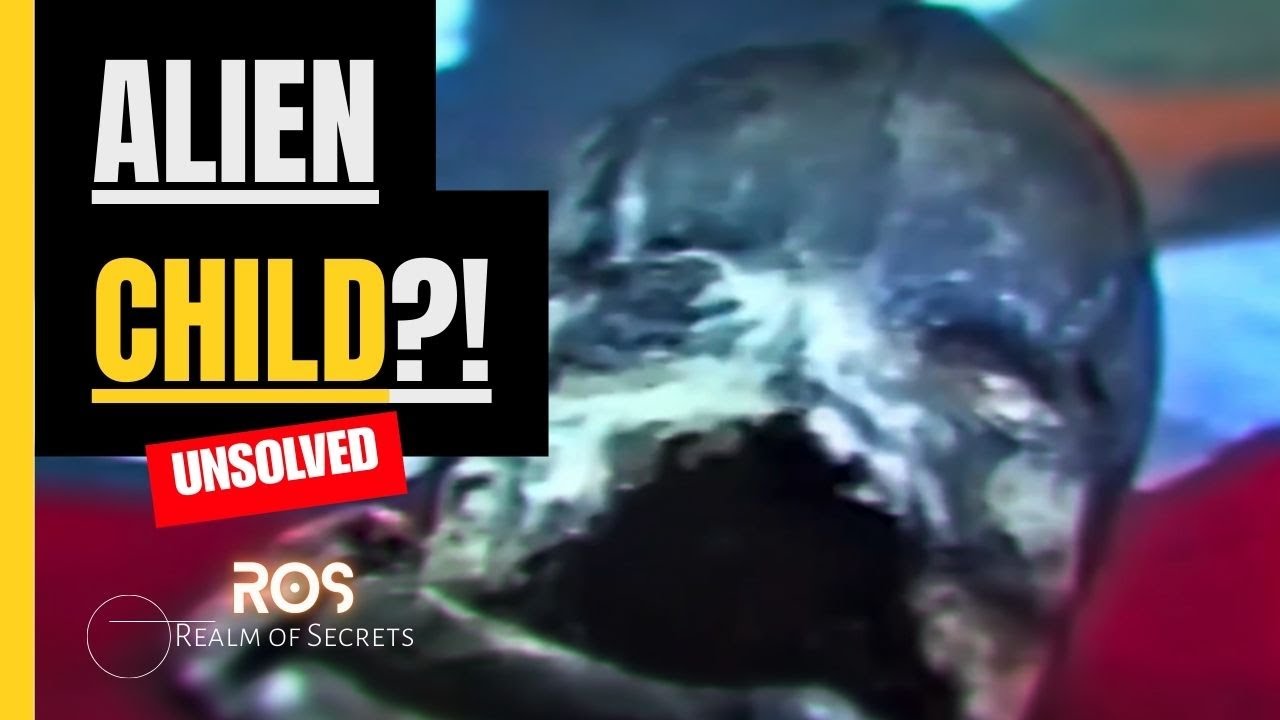 The Unsolved Mystery of Russia&rsquo;s &ldquo;Alien Child&rdquo; : ALYOSHENKA