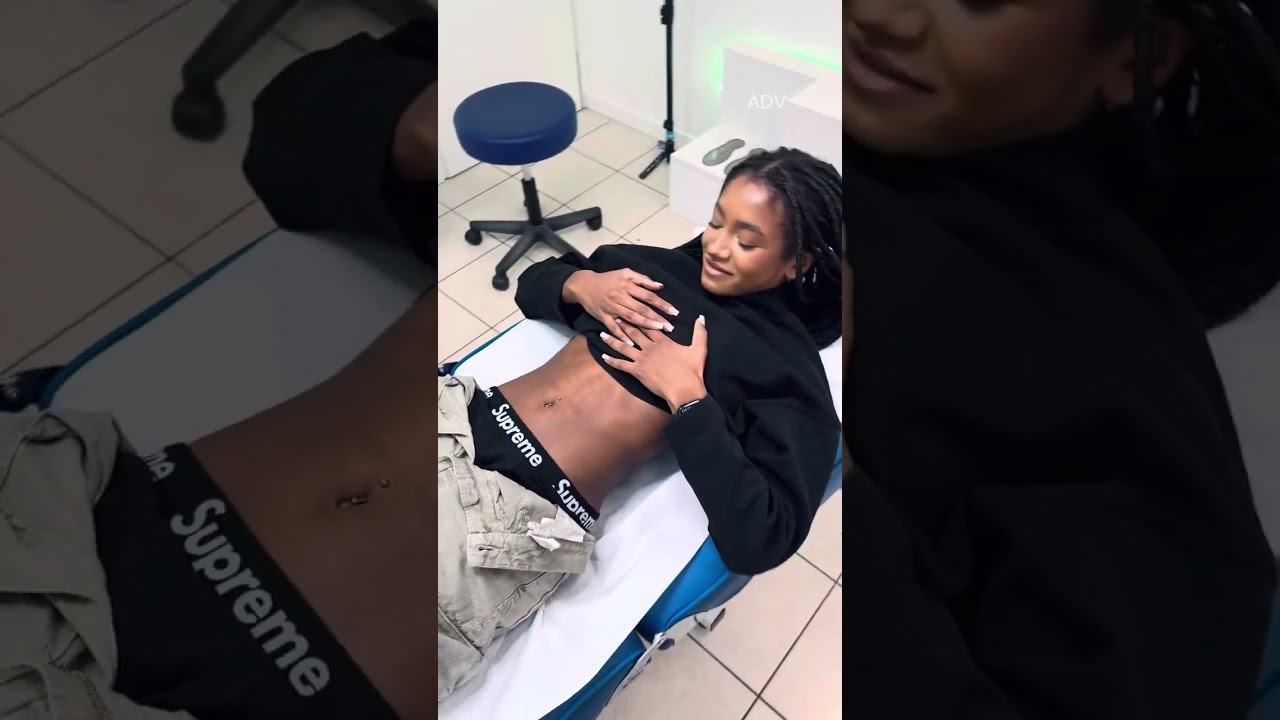 NAVEL & DIMPLE MICRODERMAL!