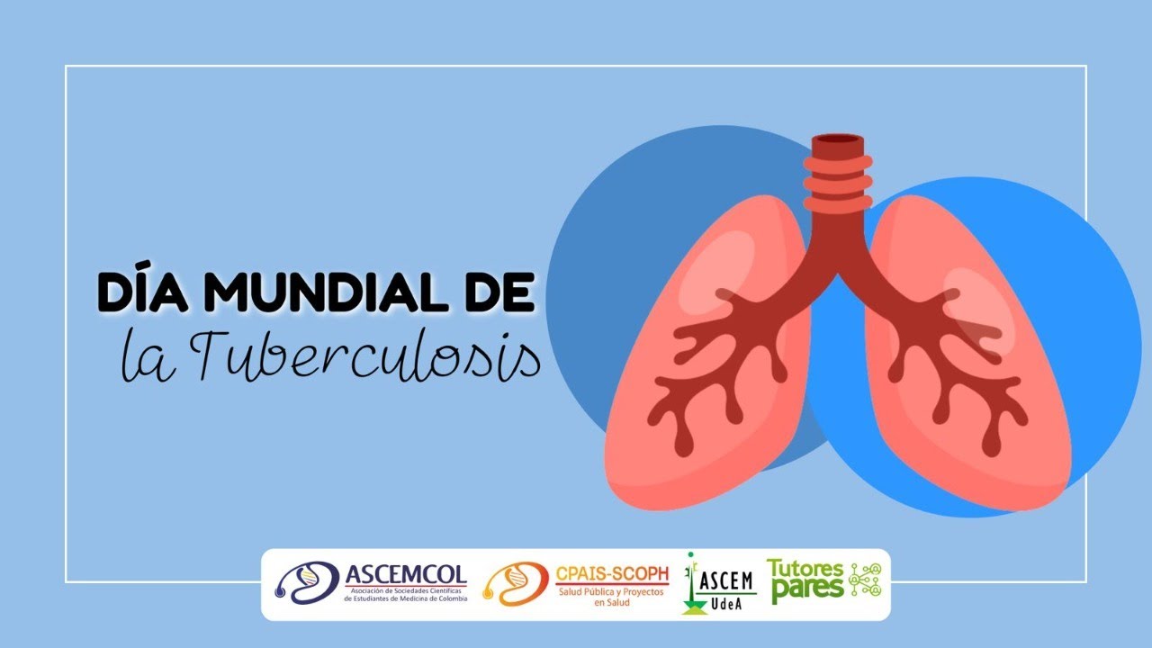 Ciclo de charlas día mundial contra la Tuberculosis- Prevención ,diagnóstico y tratamiento