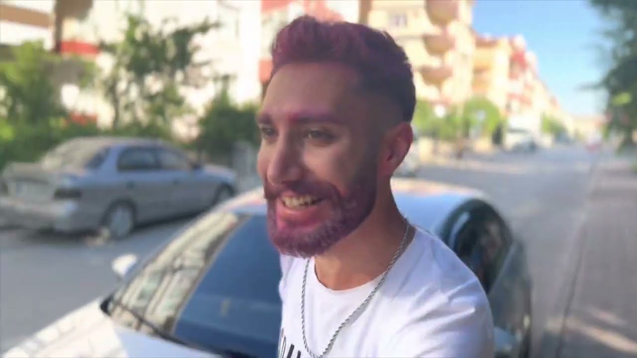 MERT SAÇINI BOYATTI