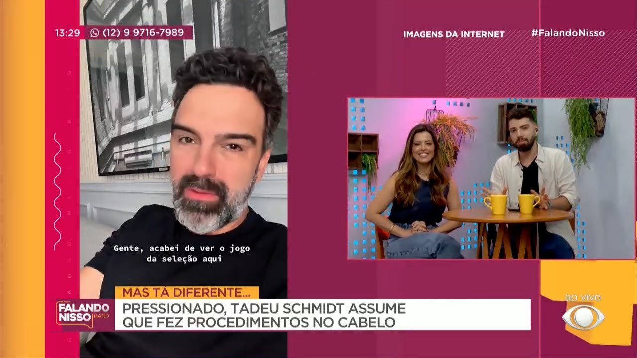 Tadeu Schmidt assume que fez procedimentos no cabelo | FALANDO NISSO