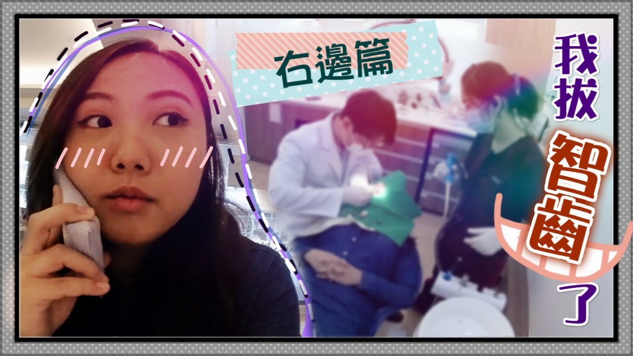 【魚乾】我又去拔智齒了！[ 無血腥畫面 ] (右邊篇)