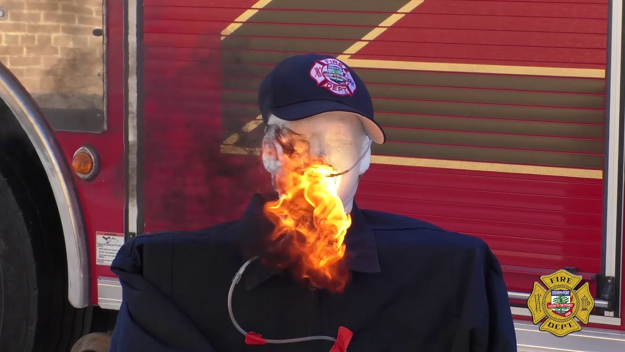 The Dangers of Smoking with Oxygen Stevens Point Burn Demo