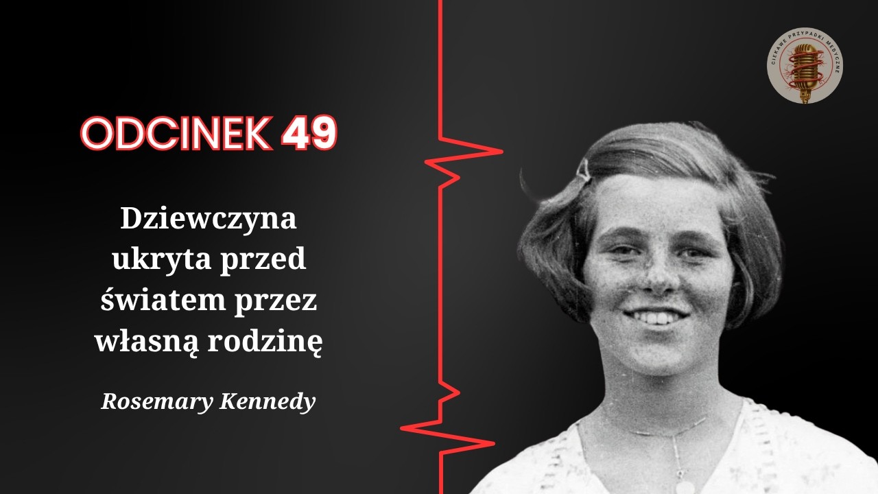 49. Rodzina zgotowała jej piekło ze strachu przed utratą reputacji. Przypadek Rosemary Kennedy.