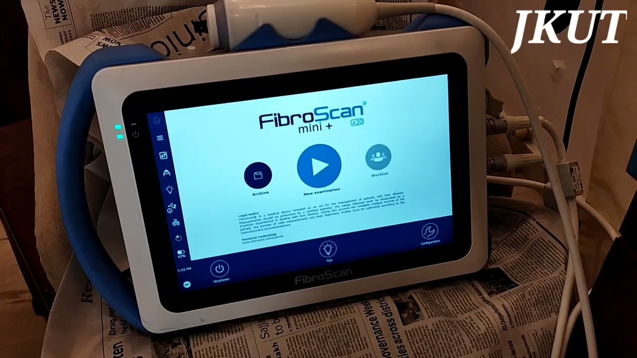 The camp included tests for Fibroscan liver test organized by Dr Raj Kumar Sharma