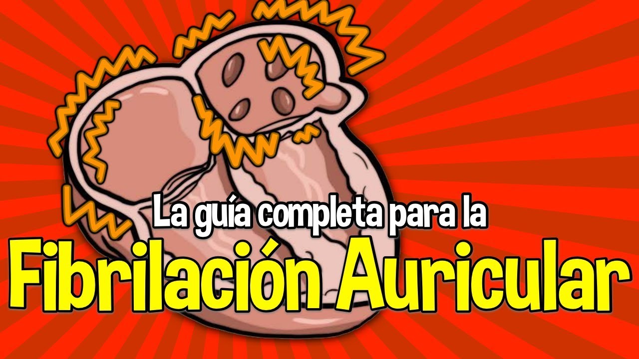 Guía para la Fibrilación Auricular: Cáusas, medicinas, síntomas, tratamientos