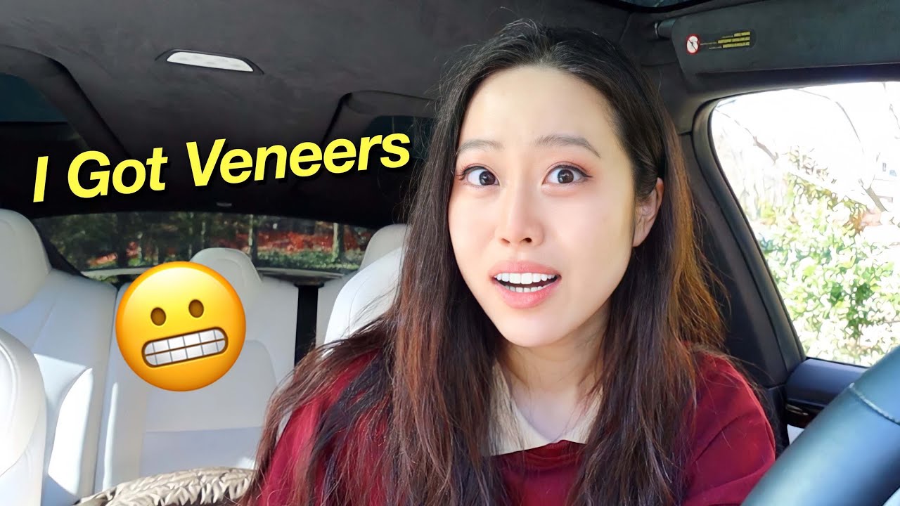 I GOT VENEERS!!!! *pranking my fiance