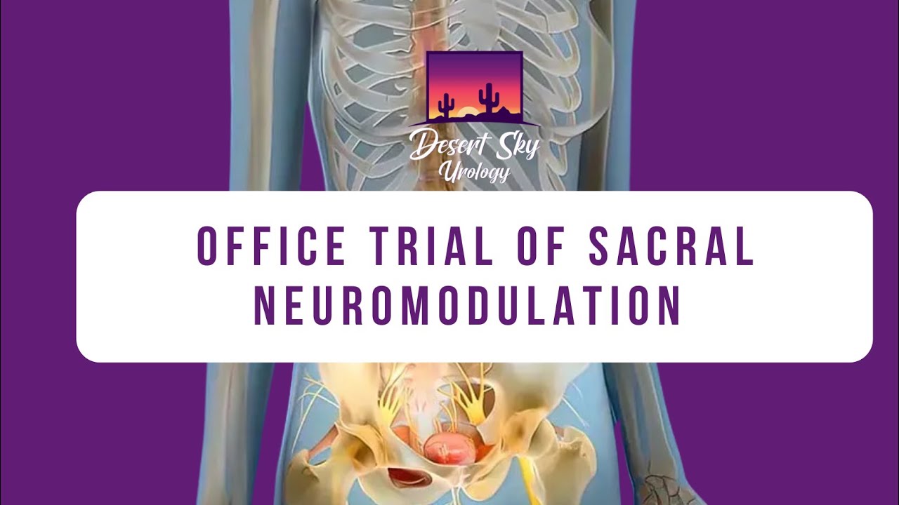 Office Trial of Sacral Neuromodulation | Overactive Bladder & Urinary Retention Treatment
