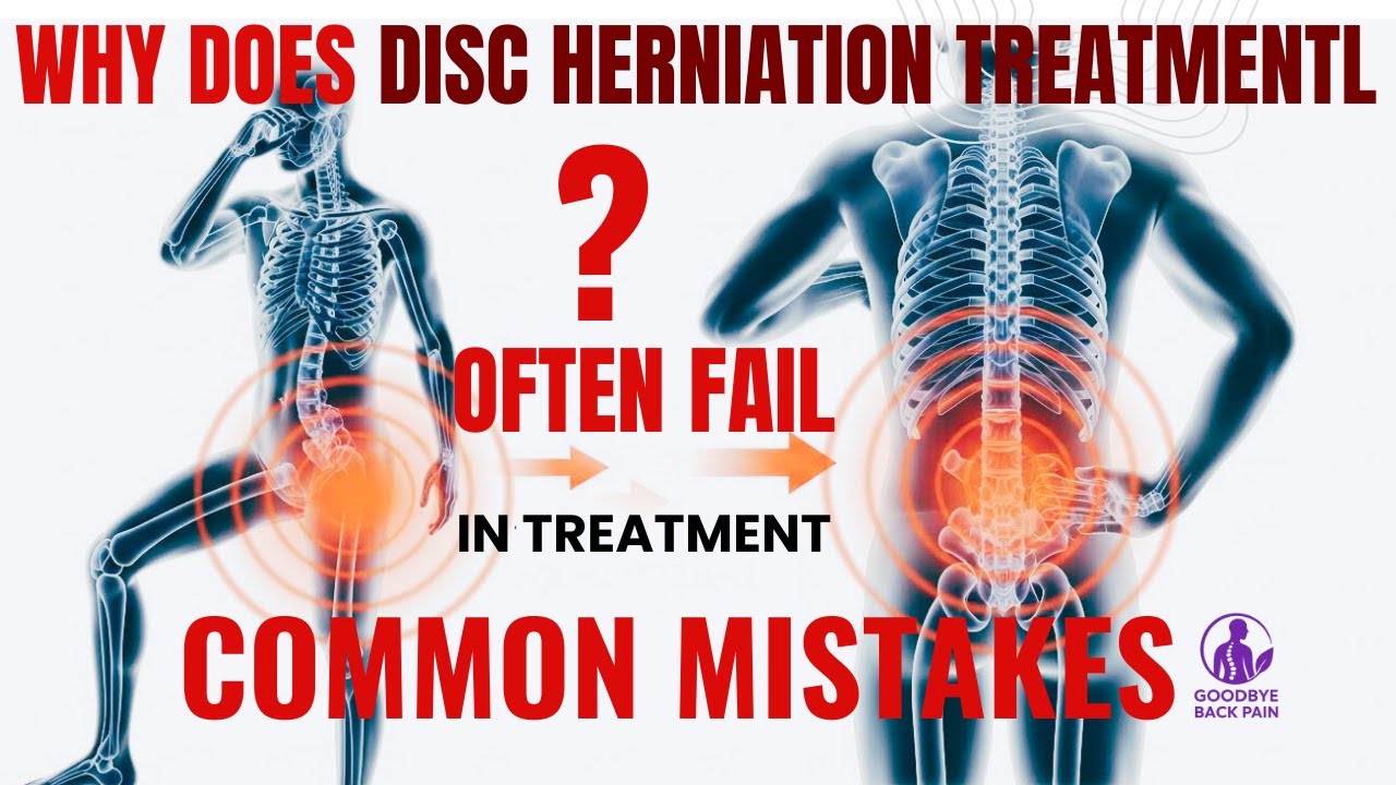 WHY Disc Herniation Treatment Fails: The 3 Biggest Mistakes & The Path to True Healing