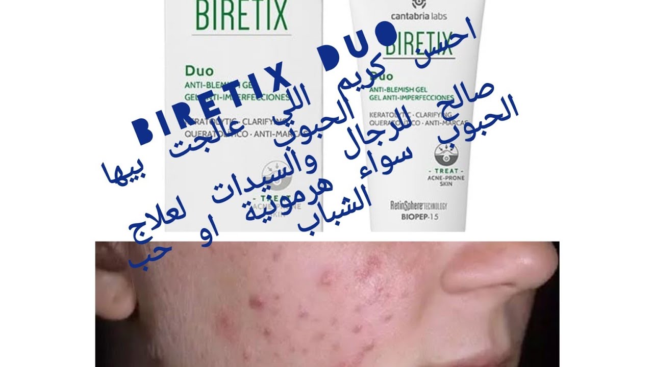 biretix duo anti imperfections ✅️كريم لعلاج حبوب البشرة سواء هرموني او حب الشباب صالح لرجال والنساء