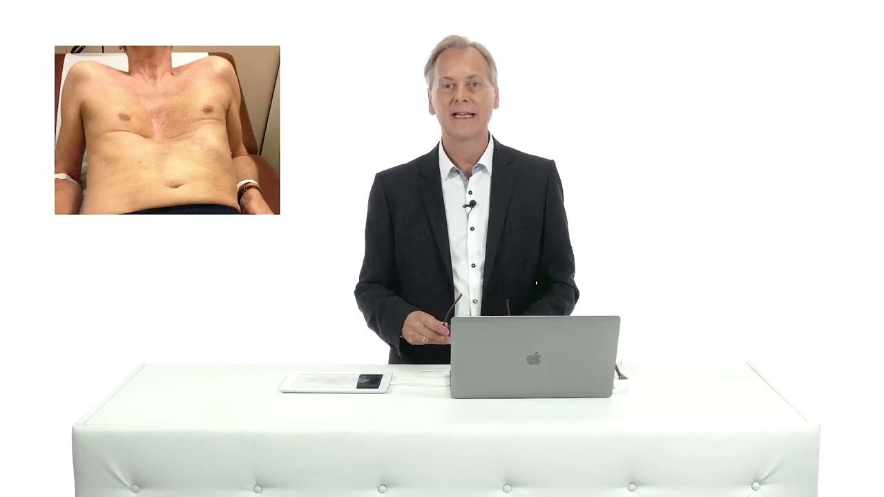How can a funnel chest affect the echocardiogram?