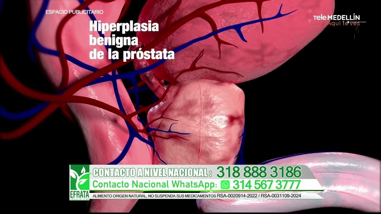 🔴 Hora 13 Noticias - Miércoles, 4 de febrero de 2026, emisión 1:00 p. m.