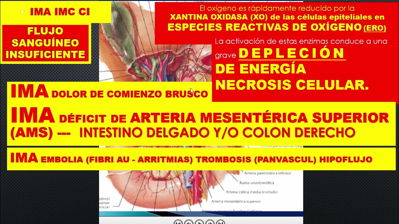 SINTESIS ABDOMEN AGUDO VASCULAR