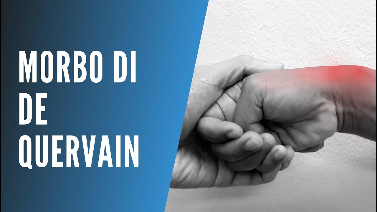 👍 Morbo di De Quervain: Rimedi e Esercizi per Eliminare il Dolore al Pollice e Polso! 👍