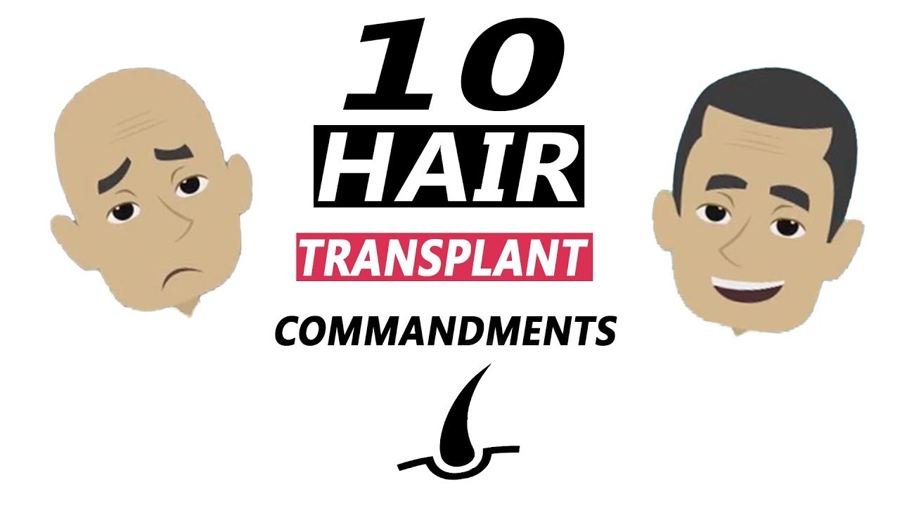 10 Things you should know before your Hair Transplant!